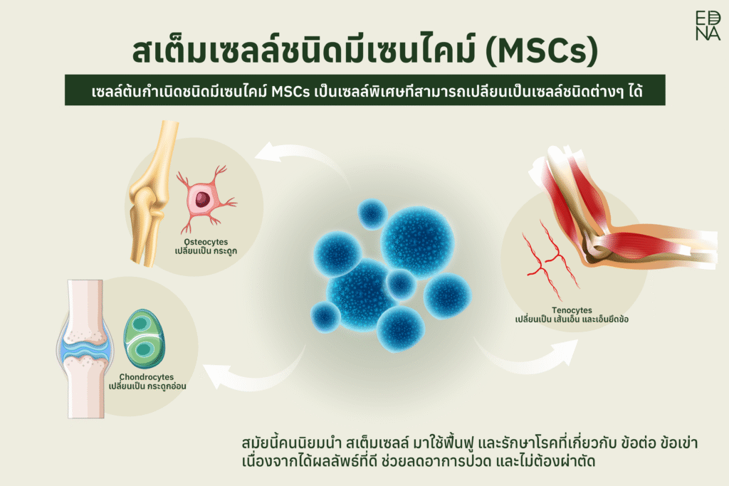 สเต็มเซลล์ ชนิดมีเซนไคม์ (MSCs)